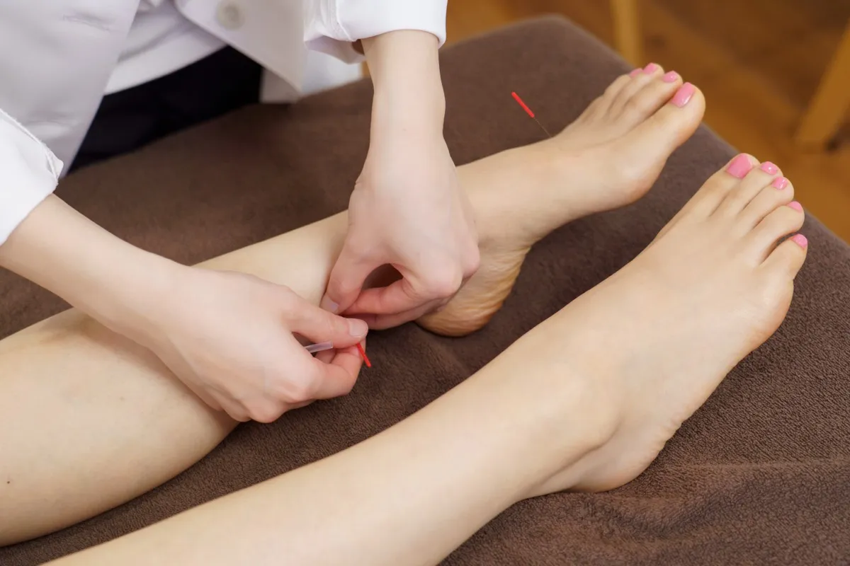 スタッフによる足への鍼灸施術